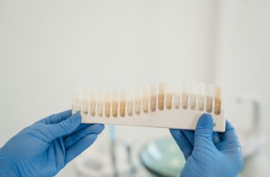 Close up Photo of a Tooth Shade Guide 380x250 - Why Generic Veneers Can Never Match Custom Precision