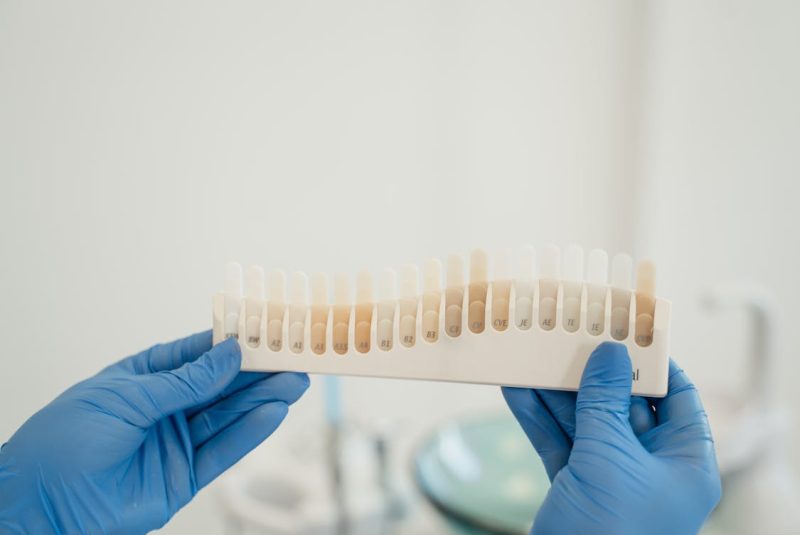 Why Generic Veneers Can Never Match Custom Precision Close up Photo of a Tooth Shade Guide 800x535 - Why Generic Veneers Can Never Match Custom Precision