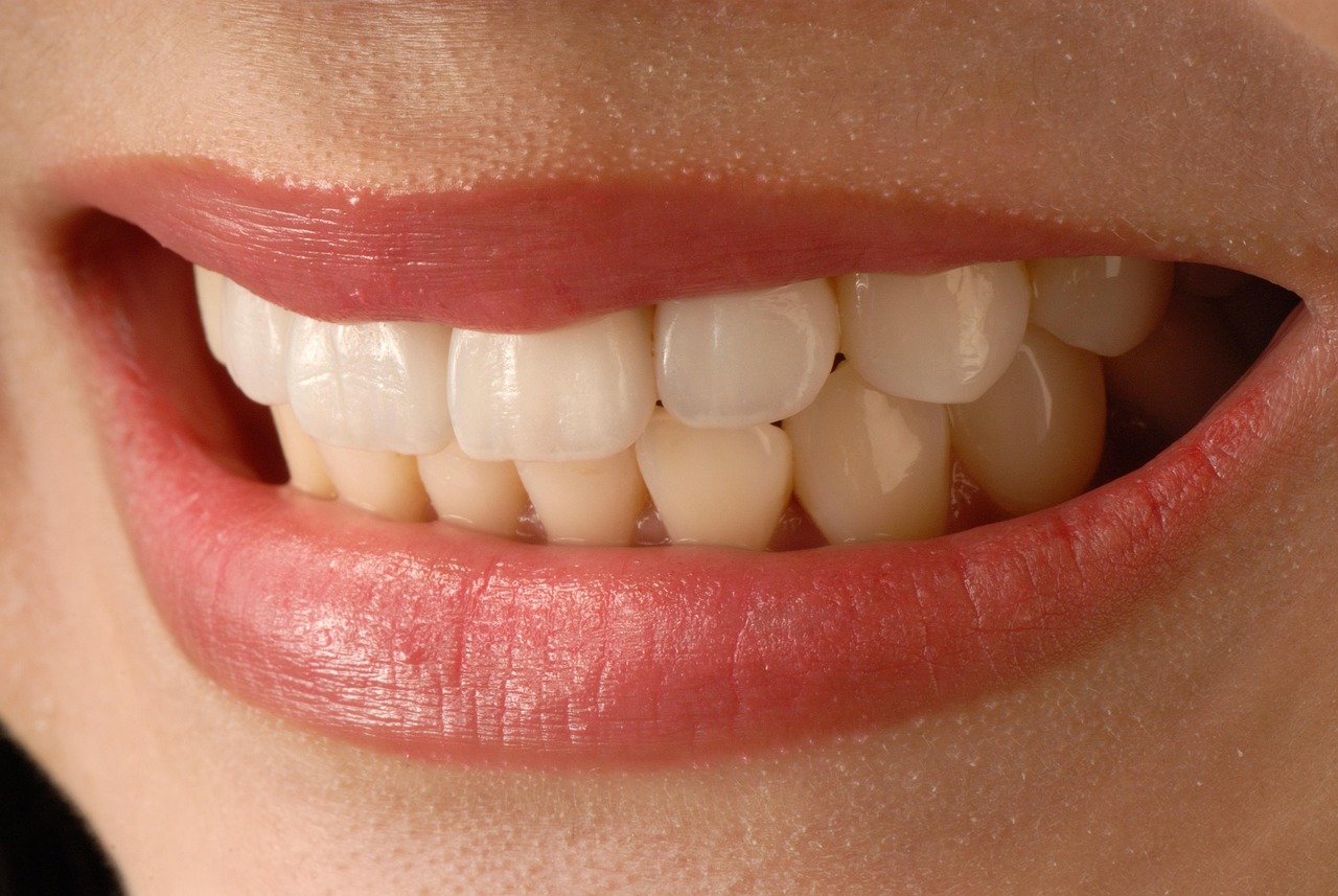 Why Generic Veneers Can Never Match Custom Precision close up of a womans teeth - Why Generic Veneers Can Never Match Custom Precision