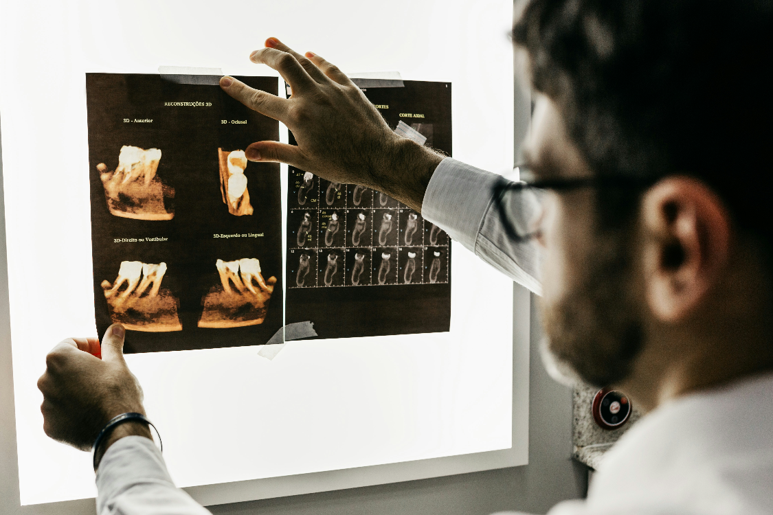 a doctor looking at an xray of teeth - 5 Key Differences Between RIS and PACS You Should Know