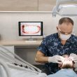 Dentist in surgical mask performing a dental check up on a patient 110x110 - The IRS Just Raised HSA Limits for 2026 — Here's Why That Matters for Texas Patients Considering Full-Mouth Implants