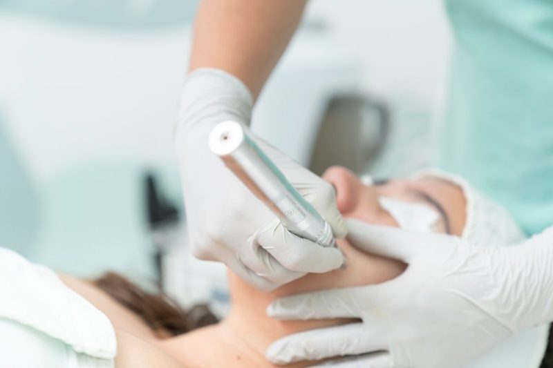 Close up of a cosmetic treatment being performed in a clinic 800x533 - Brisbane clinics named among 2026 Clinic Awards finalists as industry standards rise